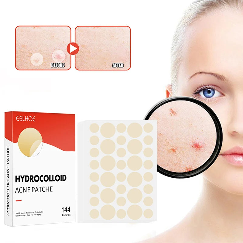 Invisible Pimple Spot Patches Hydrocolloid Set